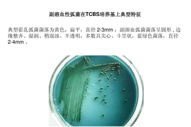 副溶血性弧菌培�ȝ���? /><span style=